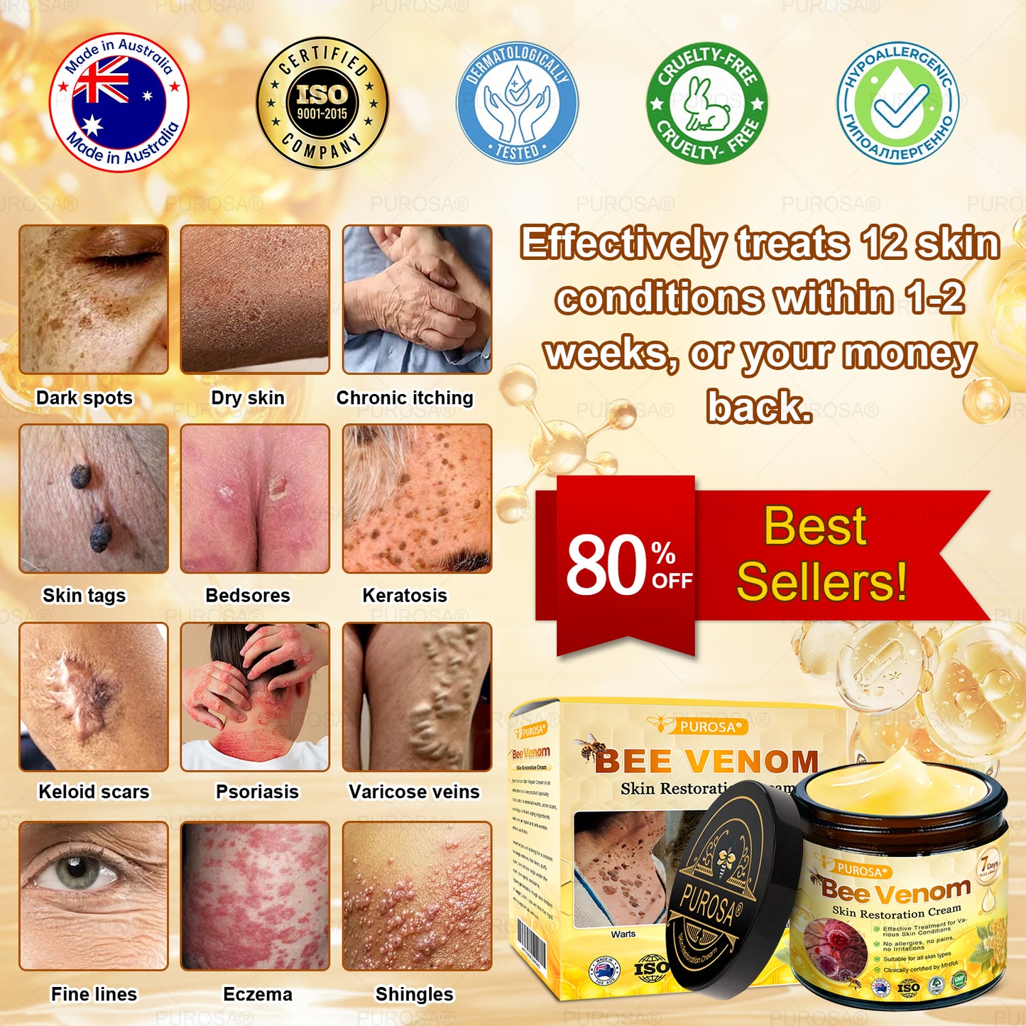 PUROSA® Bee Venom Skin Treatment Cream, Anti-aging, Hydrating, Skin Repair, Even Tone, Acne and Dark Spot Treatment, Wart and Mole Removal, Psoriasis Relief